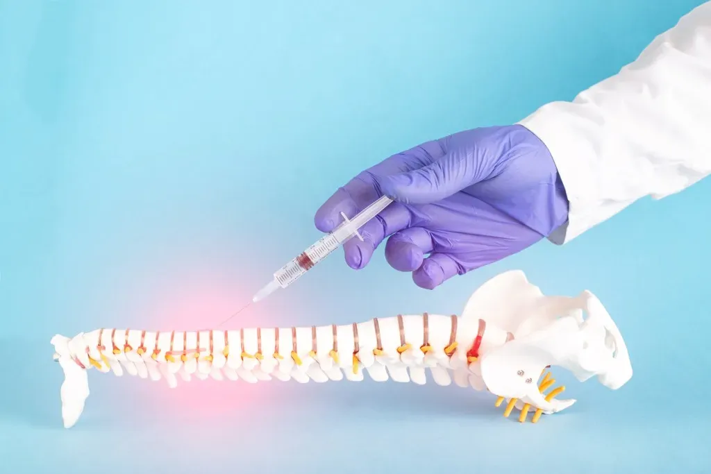 The Difference Between Epidural Steroid Injections and Nerve Blocks